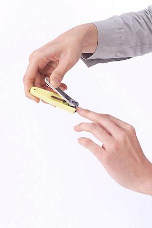 ストーマパウチの漏れがある場合の対応