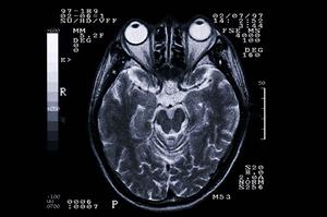 インプラント生活を早良区で充実させる