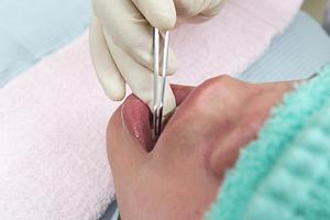 豊島区周辺で矯正治療が得意な歯科医院